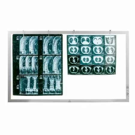 Негатоскоп TAGLER НСД-2 2-кадровый светодиодный