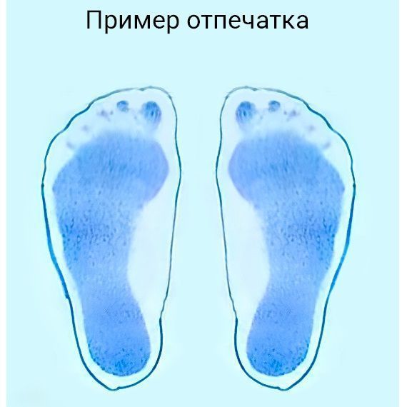 Плантограф TAGLER для определения плоскостопия